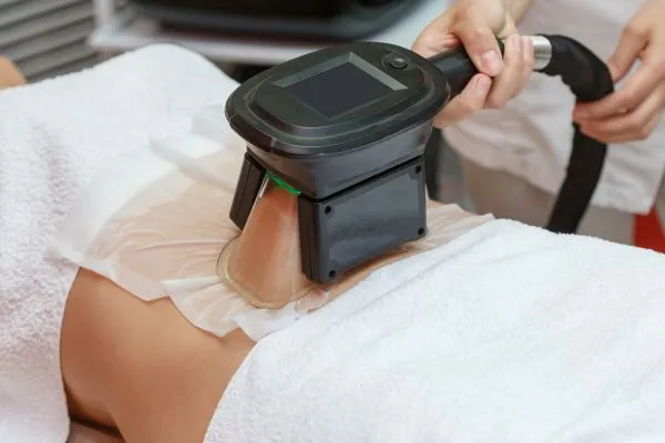 Image of person having fat freezing treatment to help weight gain Rochford