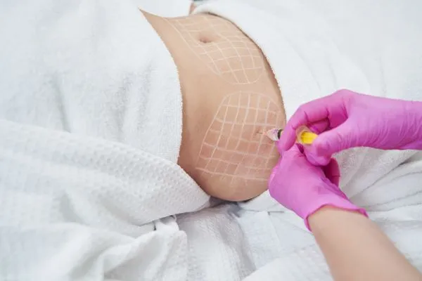 image of fat dissolving injections on love handles to help combat weight gain Rochford