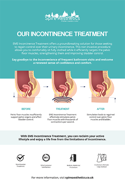 image to show how EMS treatment works for female urinary incontinence Rochford