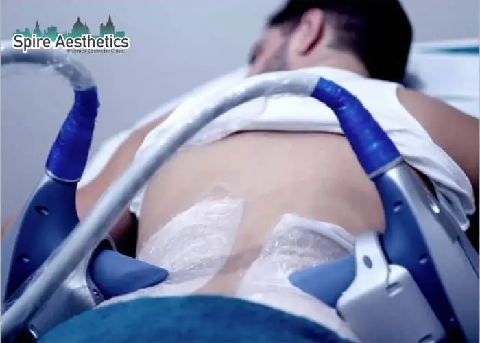 Man having fat freezing treatment done on love handles before a competitions Rochford to create a sculpted look.