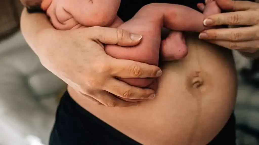 Why Is My Stomach Still Big After Pregnancy Rochford?